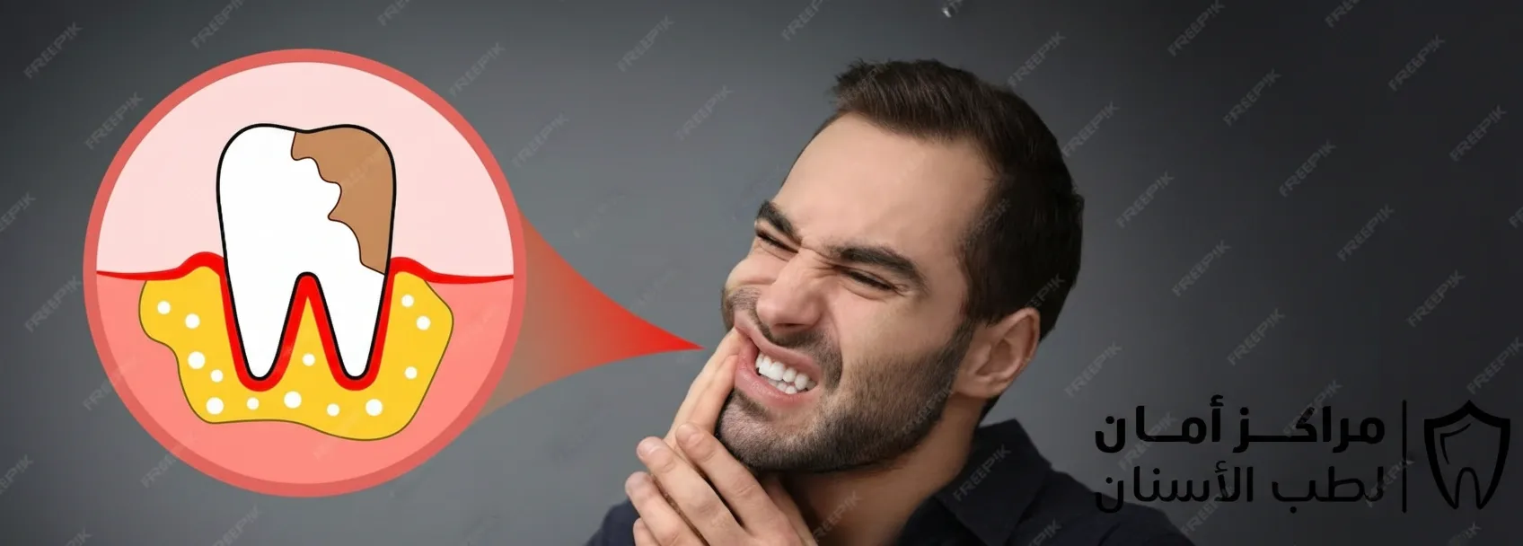 ارخص اسعار زراعة الاسنان في مصر