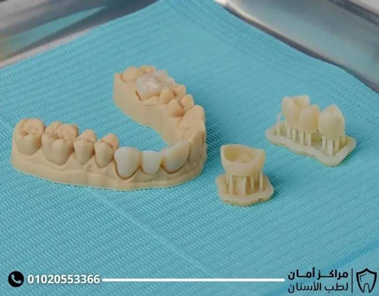 هل زراعة الاسنان مؤلمة